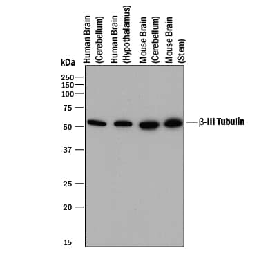 Beta-III Tubulin Antibody: Neuronal Marker (Clone TuJ-1): R&D Systems