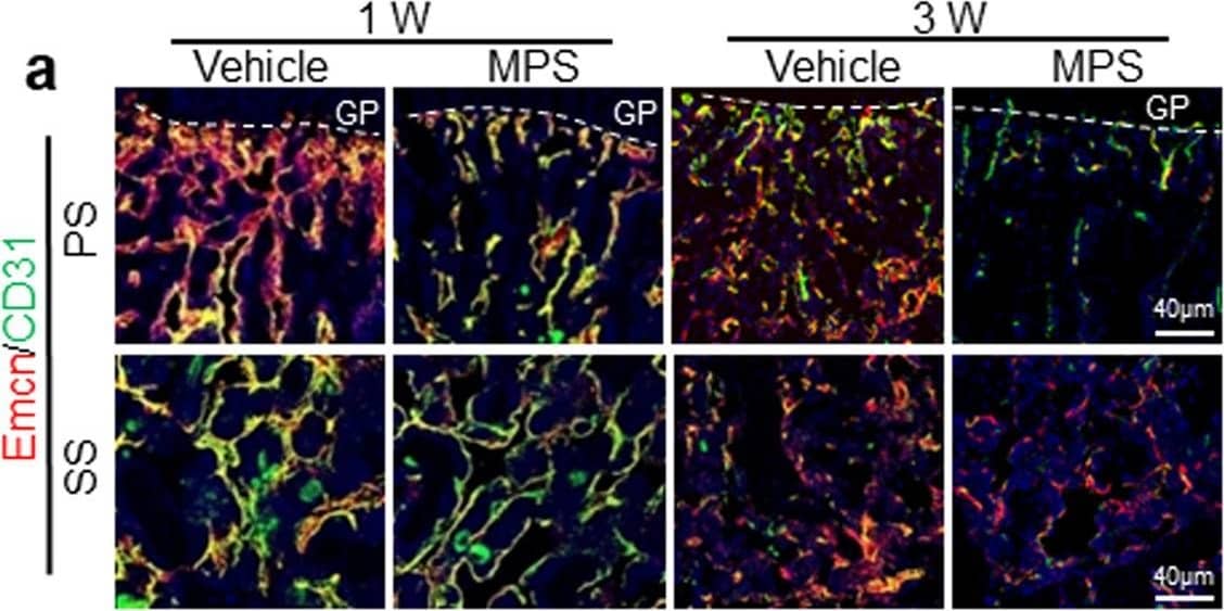 Detection of Mouse CD31/PECAM-1 by Immunocytochemistry/ Immunofluorescence Detection of Mouse CD31/PECAM-1 by Immunocytochemistry/ Immunofluorescence