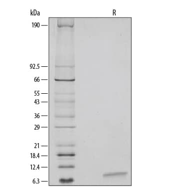 Recombinant Mouse IL-4 Protein, CF (404-ML/CF): Novus Biologicals