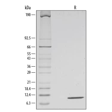 Recombinant Mouse IL-13 Protein 413-ML-005: R&D Systems