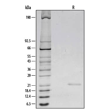 Recombinant Human Il 6 Protein 206 Il 010 R D Systems