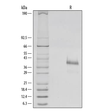 Recombinant Human R-Spondin 1 Protein 4645-RS-025: R&D Systems