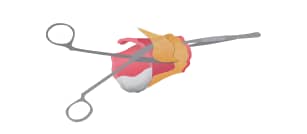 Protocol for Isolation of Human Adult Epithelial Step 5