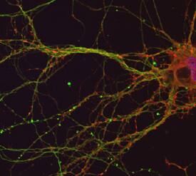 IHC-Images: Synaptophysin: R&D Systems