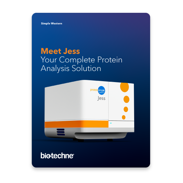 Jess Instrument Brochure Icon