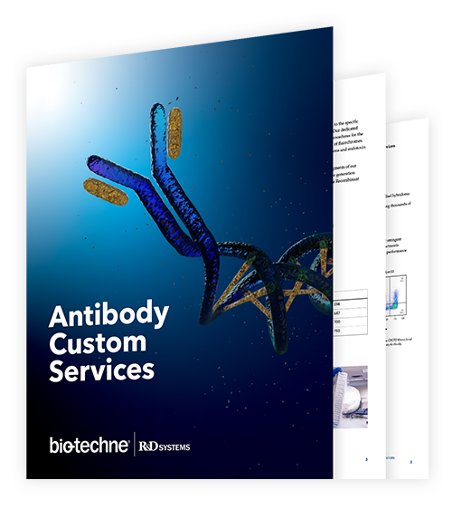 Antibody Custom Services