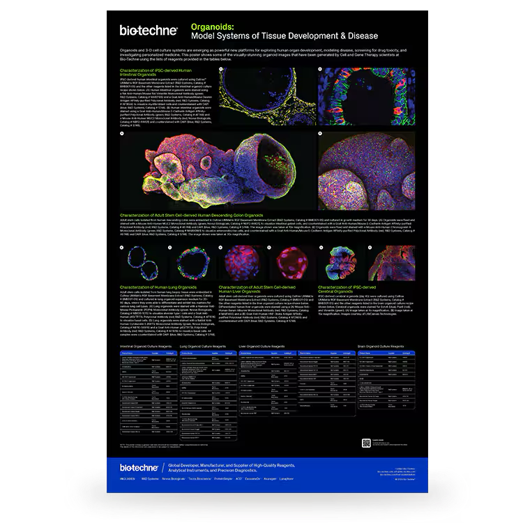Organoids: Model Systems of Tissue Development and Disease Poster