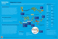 Epigenetics in Cancer Poster