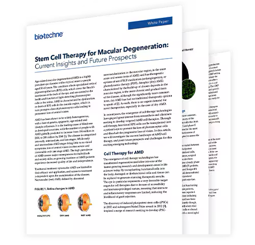 Stem cell therapy for macular degeneration white paper
