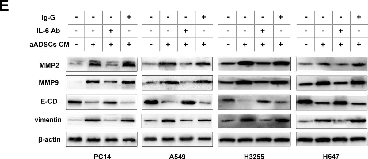 Detection of Human IgG by Western Blot