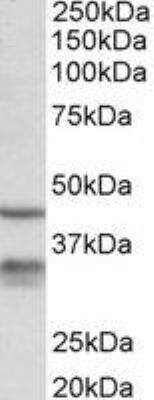 Western Blot: 11 beta-HSD1 Antibody [NBP2-27469]
