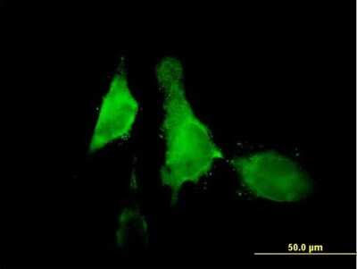 Immunocytochemistry/ Immunofluorescence: 12-Lipoxygenase Antibody [H00000239-B01P]