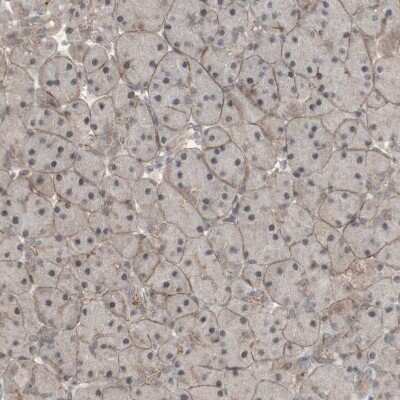 Immunohistochemistry-Paraffin: 12-Lipoxygenase Antibody [NBP1-90338]