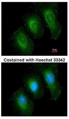 Immunocytochemistry/ Immunofluorescence: 14-3-3 epsilon Antibody [NBP1-32695]