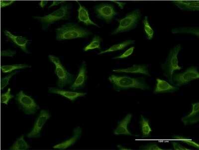 Immunocytochemistry/ Immunofluorescence: 14-3-3 gamma Antibody (1B4) [H00007532-M03]