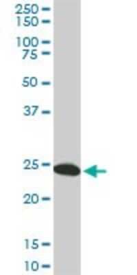 Western Blot: 14-3-3 gamma Antibody (6A10) [H00007532-M02]