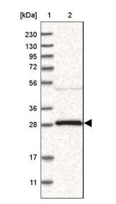 Western Blot: 14-3-3 gamma Antibody [NBP2-54679]