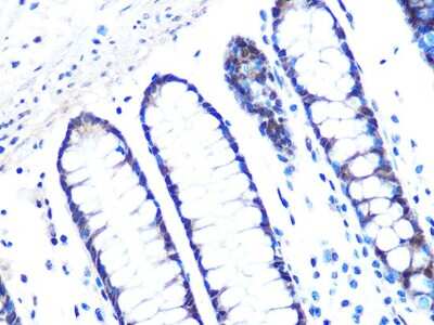 Immunohistochemistry-Paraffin: 14-3-3 sigma/Stratifin Antibody (8C8A9) [NBP3-16395]