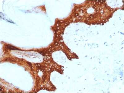 Immunohistochemistry-Paraffin: 14-3-3 sigma/Stratifin Antibody (CPTC-SFN-2) - Azide and BSA Free [NBP3-08214]