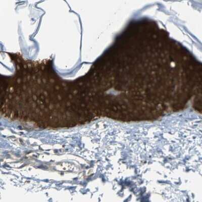 Immunohistochemistry-Paraffin: 14-3-3 sigma/Stratifin Antibody [NBP1-80610]