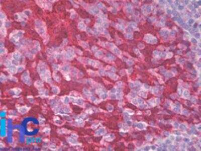 Immunohistochemistry-Paraffin: 14-3-3 sigma/Stratifin Antibody [NBP2-27072]