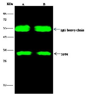 Immunoprecipitation: 14-3-3 sigma/Stratifin Antibody [NBP2-99631]
