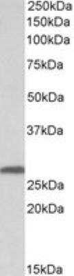 Western Blot: 14-3-3 sigma/Stratifin Antibody [NB100-2465]