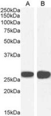 Western Blot: 14-3-3 sigma/Stratifin Antibody [NB100-2465]