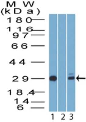 Western Blot: 14-3-3 sigma/Stratifin Antibody [NBP2-27072]