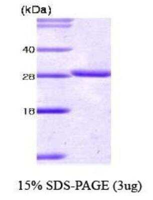 SDS-PAGE: Recombinant Human 14-3-3 tau/theta Protein [NBC1-18393]