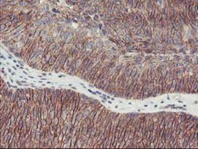 Immunohistochemistry-Paraffin: 15-Lipoxygenase 1 Antibody (OTI3G8) [NBP2-01740]