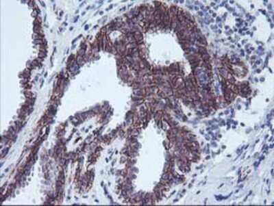 Immunohistochemistry-Paraffin: 15-Lipoxygenase 1 Antibody (OTI3G8) [NBP2-01740]