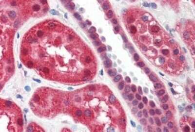 Immunohistochemistry-Paraffin: 15-Lipoxygenase 1 Antibody [NBP1-06976]