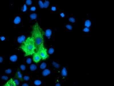 Immunocytochemistry/ Immunofluorescence: 15-Lipoxygenase 1 Antibody (OTI3G8) - Azide and BSA Free [NBP2-70169]