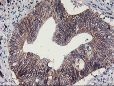 Immunohistochemistry: 15-Lipoxygenase 1 Antibody (OTI3G8) - Azide and BSA Free [NBP2-70169]