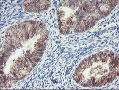 Immunohistochemistry: 15-Lipoxygenase 1 Antibody (OTI3G8) - Azide and BSA Free [NBP2-70169]