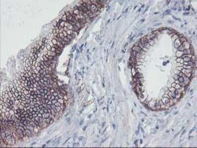 Immunohistochemistry: 15-Lipoxygenase 1 Antibody (OTI3G8) - Azide and BSA Free [NBP2-70169]