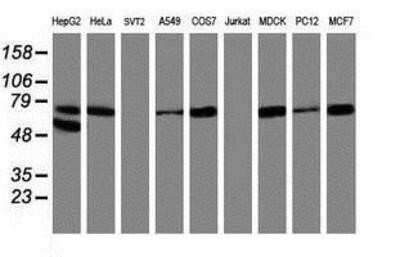 Western Blot: 15-Lipoxygenase 1 Antibody (OTI3G8)Azide and BSA Free [NBP2-70169]