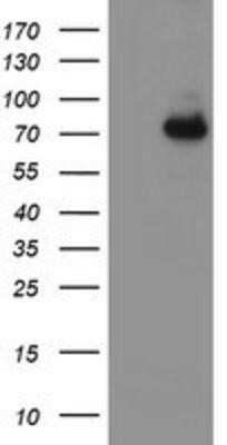 Western Blot: 15-Lipoxygenase 1 Antibody (OTI3G8)Azide and BSA Free [NBP2-70169]