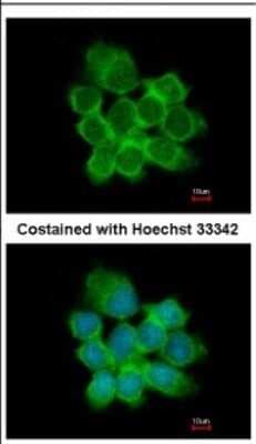 Immunocytochemistry/ Immunofluorescence: 15-PGDH/HPGD Antibody [NBP2-21588]