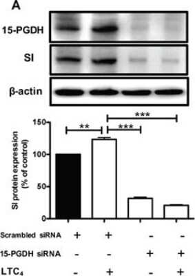 Knockdown Validated: 15-PGDH/HPGD Antibody [NB200-179]