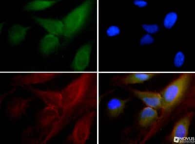 Immunocytochemistry/ Immunofluorescence: 15-PGDH/HPGD Antibody [NB200-179]
