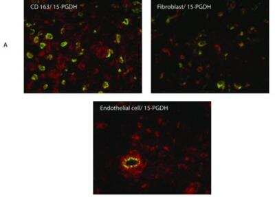Immunohistochemistry: 15-PGDH/HPGD Antibody [NB200-179]