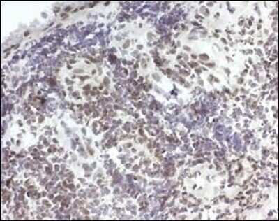 Immunohistochemistry-Paraffin: 15-PGDH/HPGD Antibody [NB200-179]