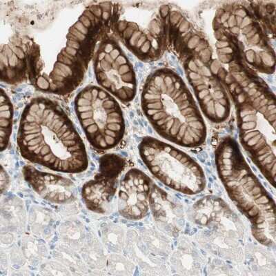 Immunohistochemistry-Paraffin: 15-PGDH/HPGD Antibody [NBP1-87061]