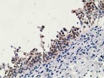 Immunohistochemistry: 15-PGDH/HPGD Antibody (OTI2C10) - Azide and BSA Free [NBP2-70933]