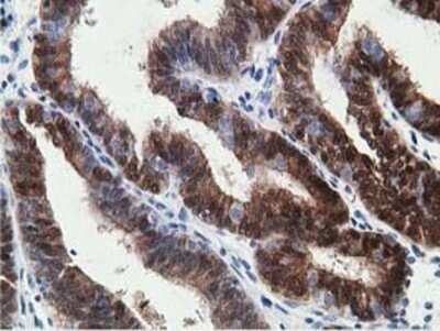 Immunohistochemistry: 15-PGDH/HPGD Antibody (OTI2C10) - Azide and BSA Free [NBP2-70933]