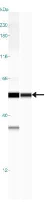 Simple Western: 15-PGDH/HPGD Antibody [NB200-179]