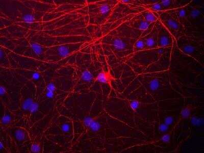Immunocytochemistry/ Immunofluorescence: NF-M Antibody [NB300-222]