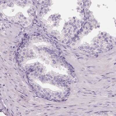Immunohistochemistry-Paraffin: 17 beta-HSD1/HSD17B1 Antibody [NBP2-39053]